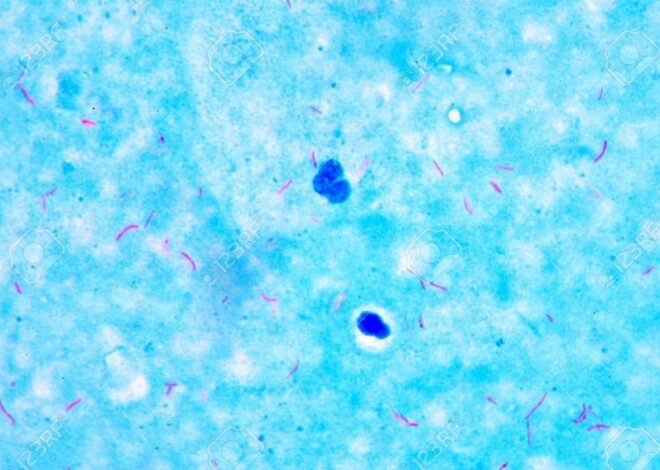 Tuberkulosis pada Ikan Akuarium